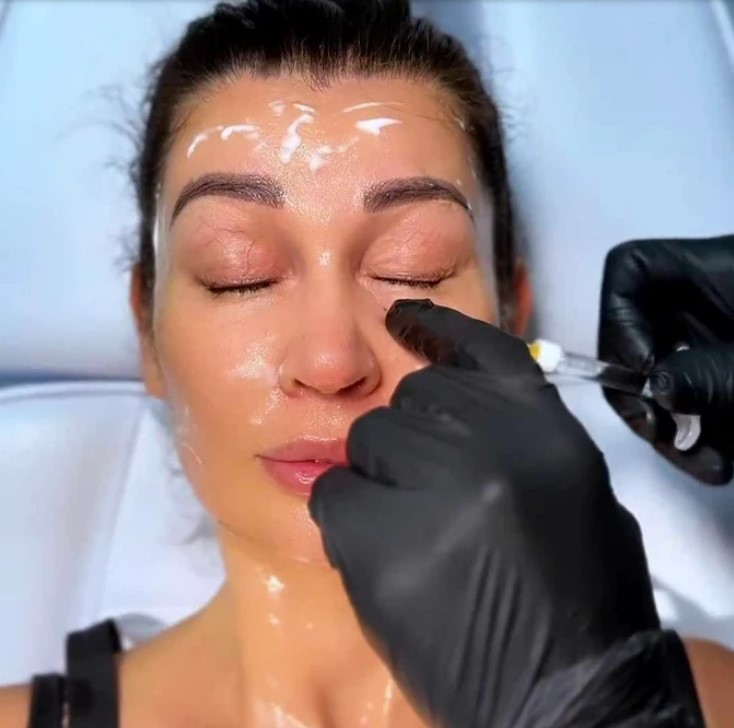 Nicoleta Luciu, o noua vizita la medicul estetician 3