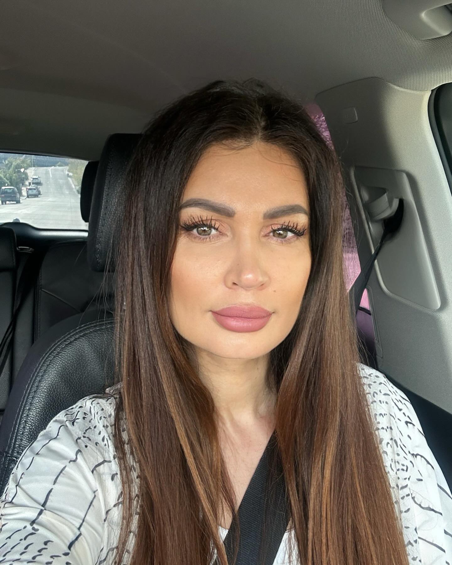 Nicoleta Luciu, o noua vizita la medicul estetician 4