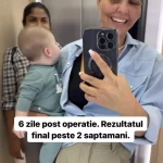 Cum arata Andreea Popescu, dupa ce si-a facut o noua operatie la fata 1