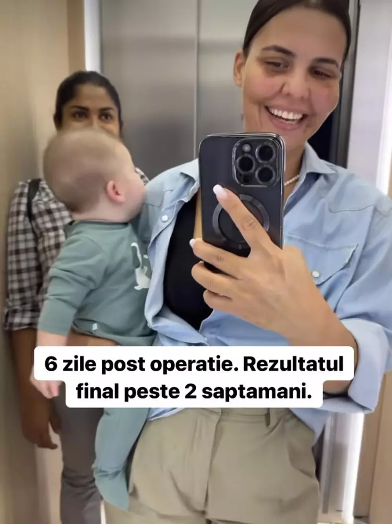 Cum arata Andreea Popescu, dupa ce si-a facut o noua operatie la fata 1