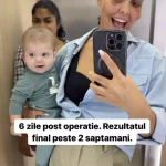 Cum arata Andreea Popescu, dupa ce si-a facut o noua operatie la fata 2