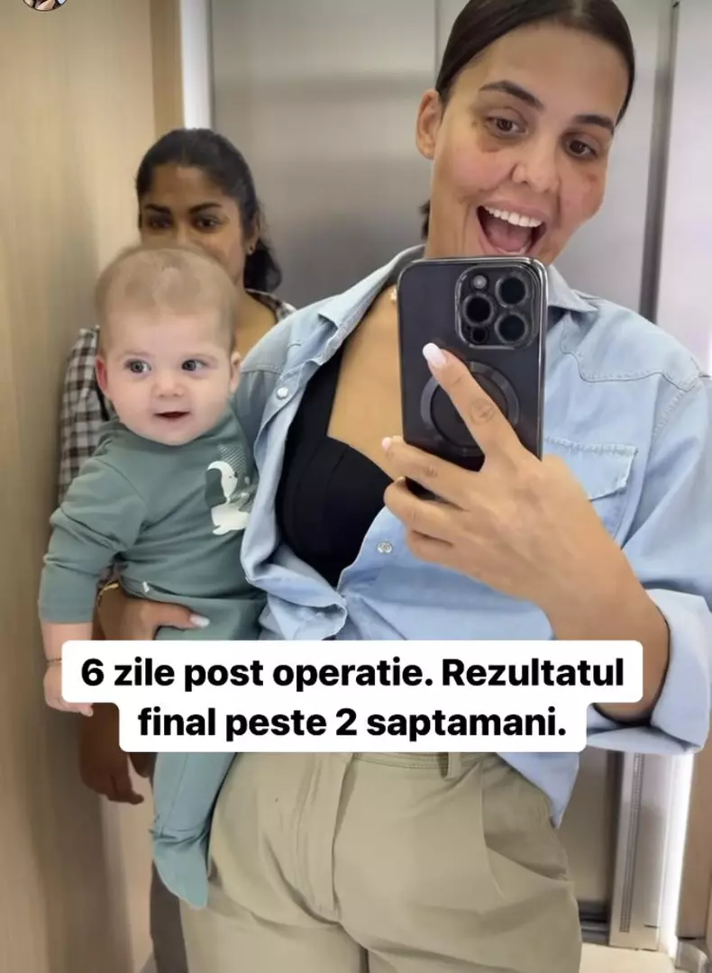 Cum arata Andreea Popescu, dupa ce si-a facut o noua operatie la fata 2