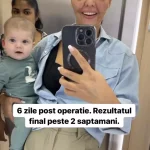 Cum arata Andreea Popescu, dupa ce si-a facut o noua operatie la fata 3