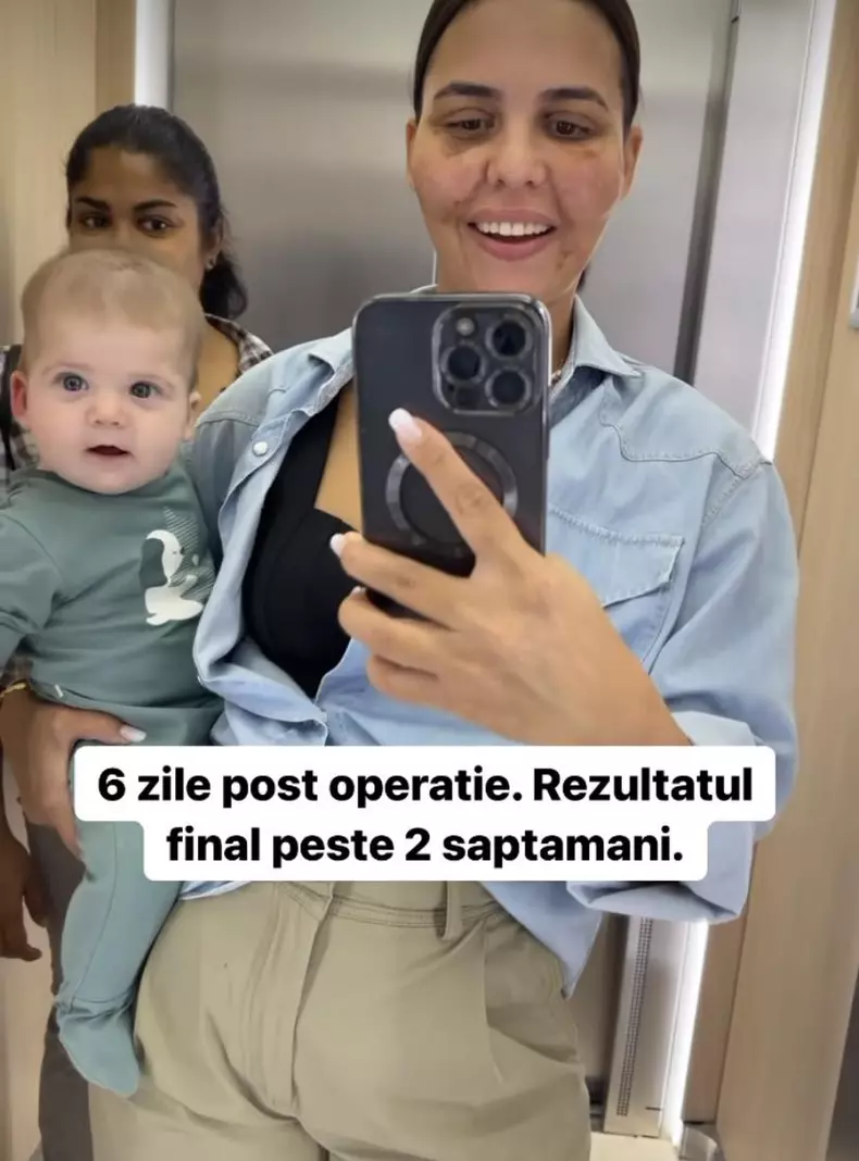 Cum arata Andreea Popescu, dupa ce si-a facut o noua operatie la fata 3