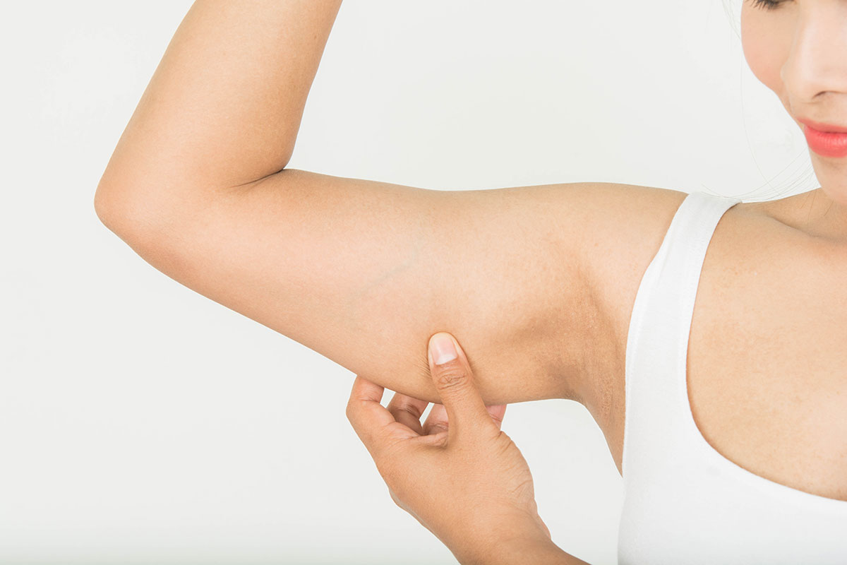 Cum sa scapi de grasimea de pe brate usor si rapid