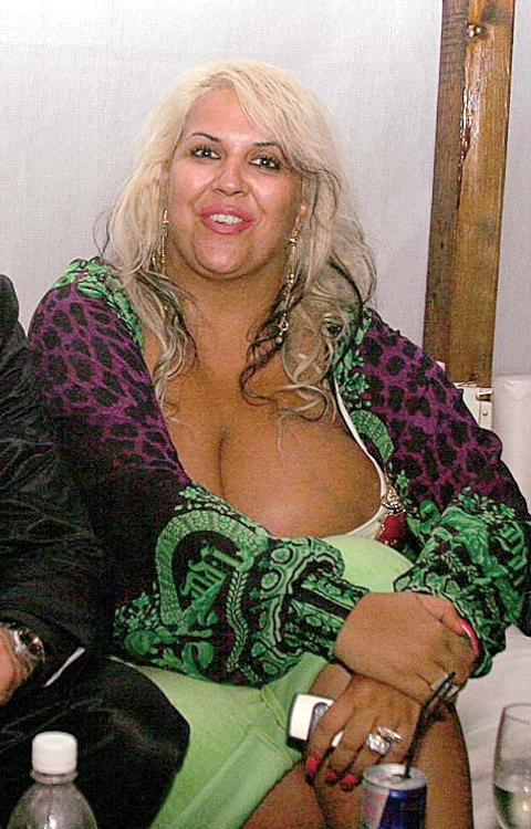 Vedete din Romania, inainte si dupa operatiile estetice 15