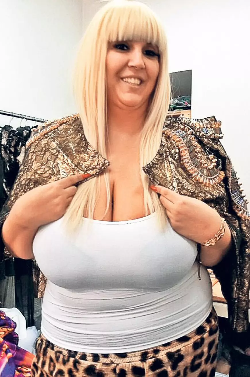 Vedete din Romania, inainte si dupa operatiile estetice 21