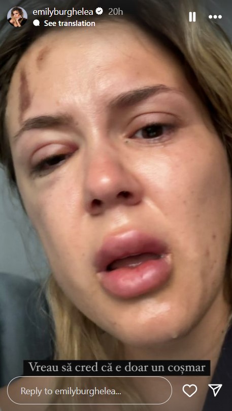 Emily Burghelea a trecut prin momente de groaza