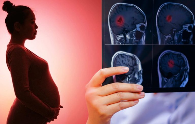Sarcina micșorează părți ale creierului și lasă urme ireversibile pentru mamă. Cum explică oamenii de știință