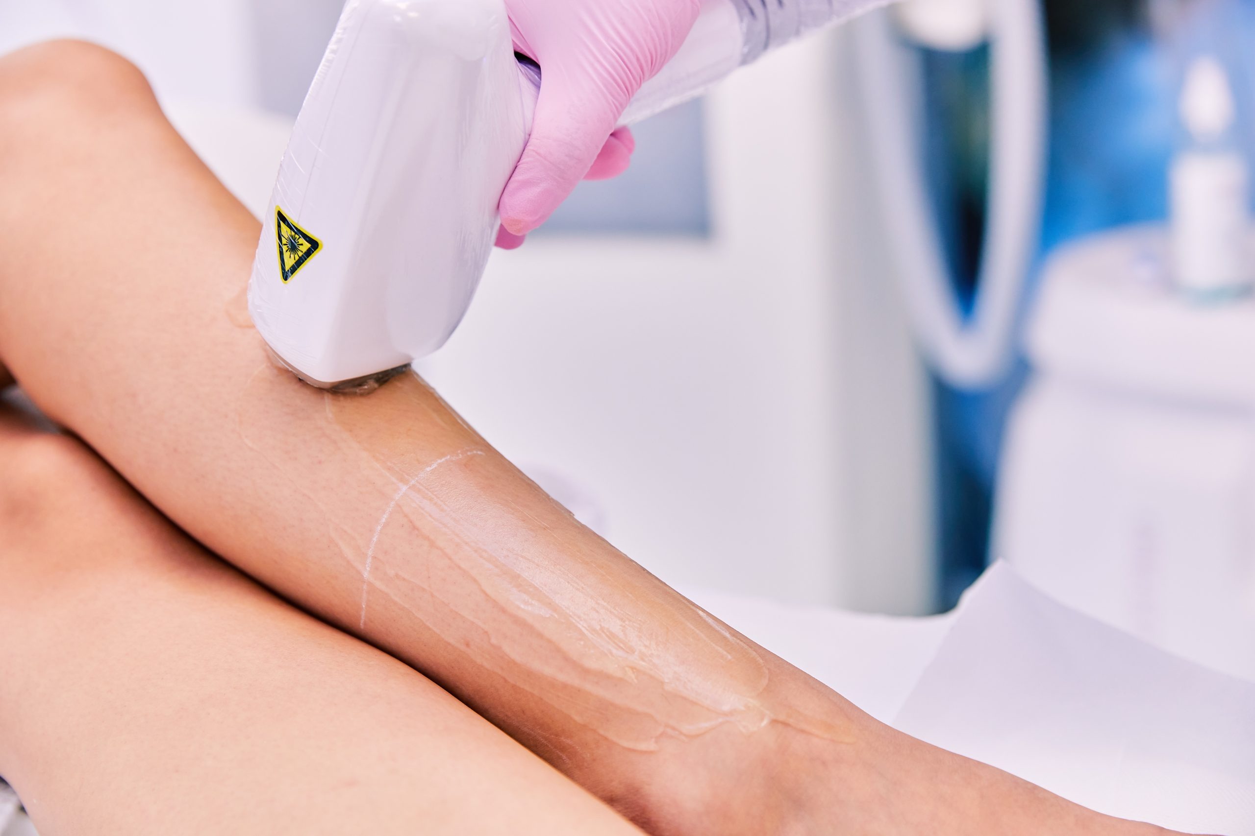 Ce trebuie să faci înainte de o ședință de epilare definitivă