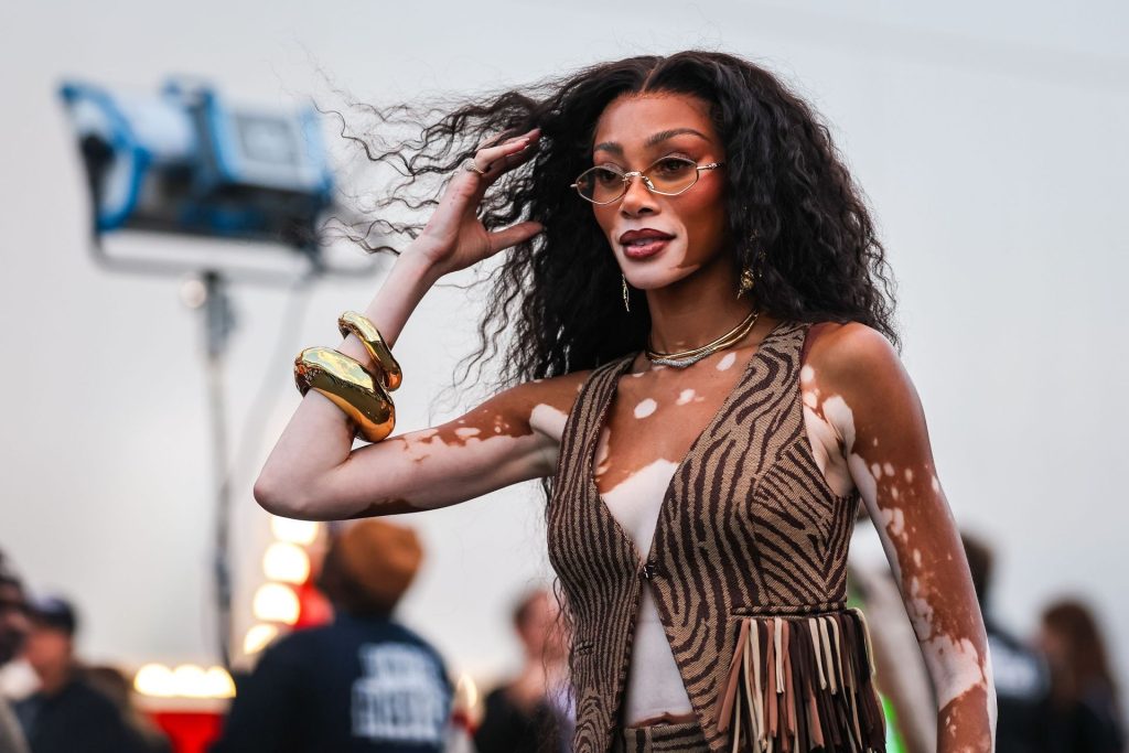 Winnie Harlow, strălucitoare pe străzile din Miami