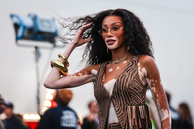 Winnie Harlow, strălucitoare pe străzile din Miami – ținuta care a atras toate privirile