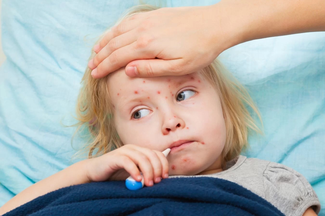 Adevărul despre rujeolă și vaccin