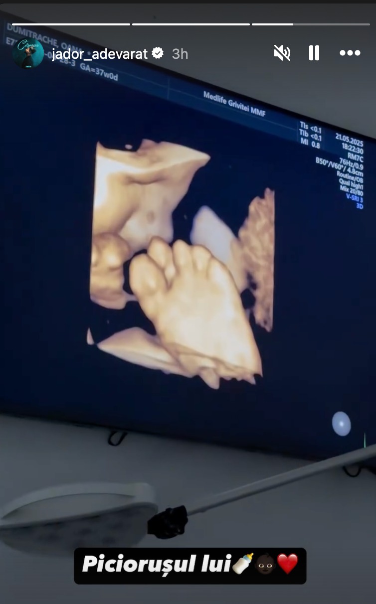 Poza postată de Jador de la ecografie cu fiul lui