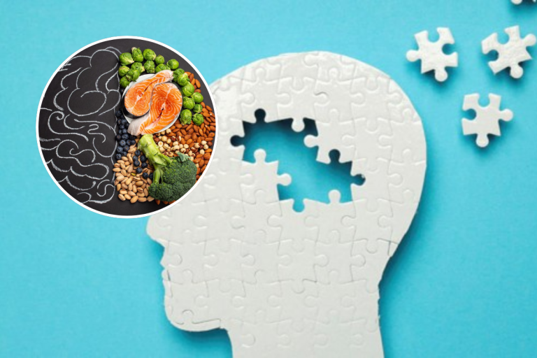 7 alimente recomandate de neurologi pentru reducerea riscului de demență