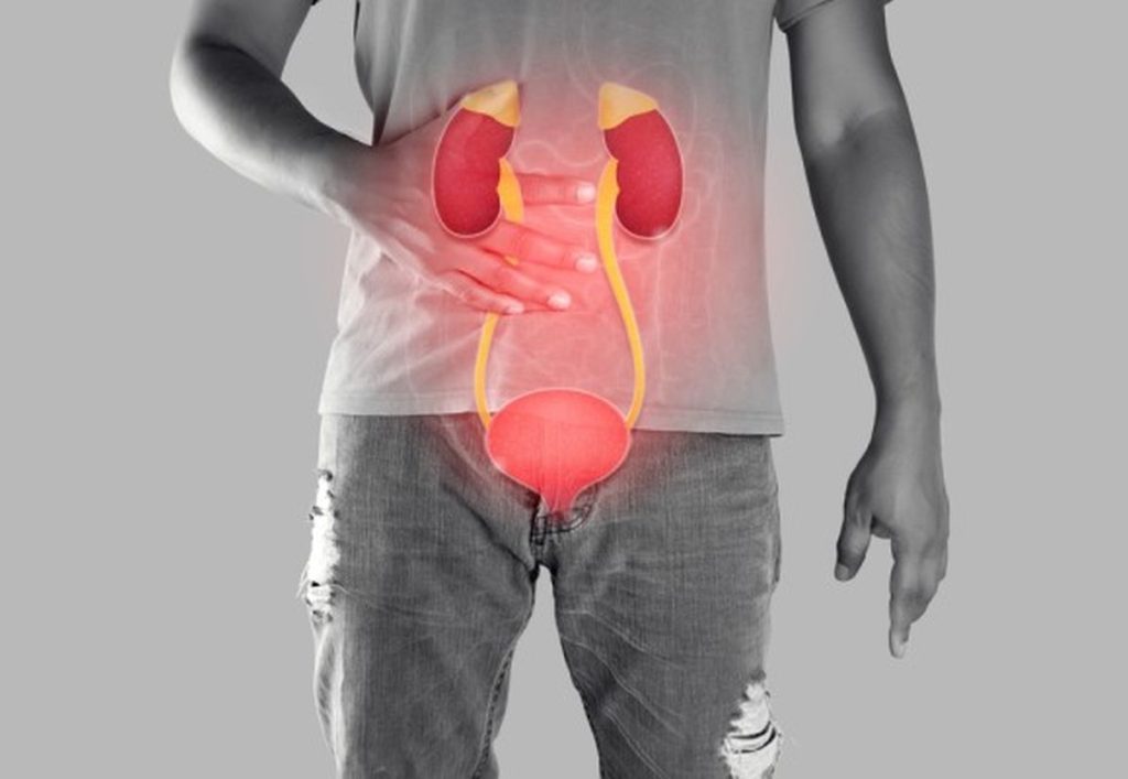 Infecții urinare la bărbați