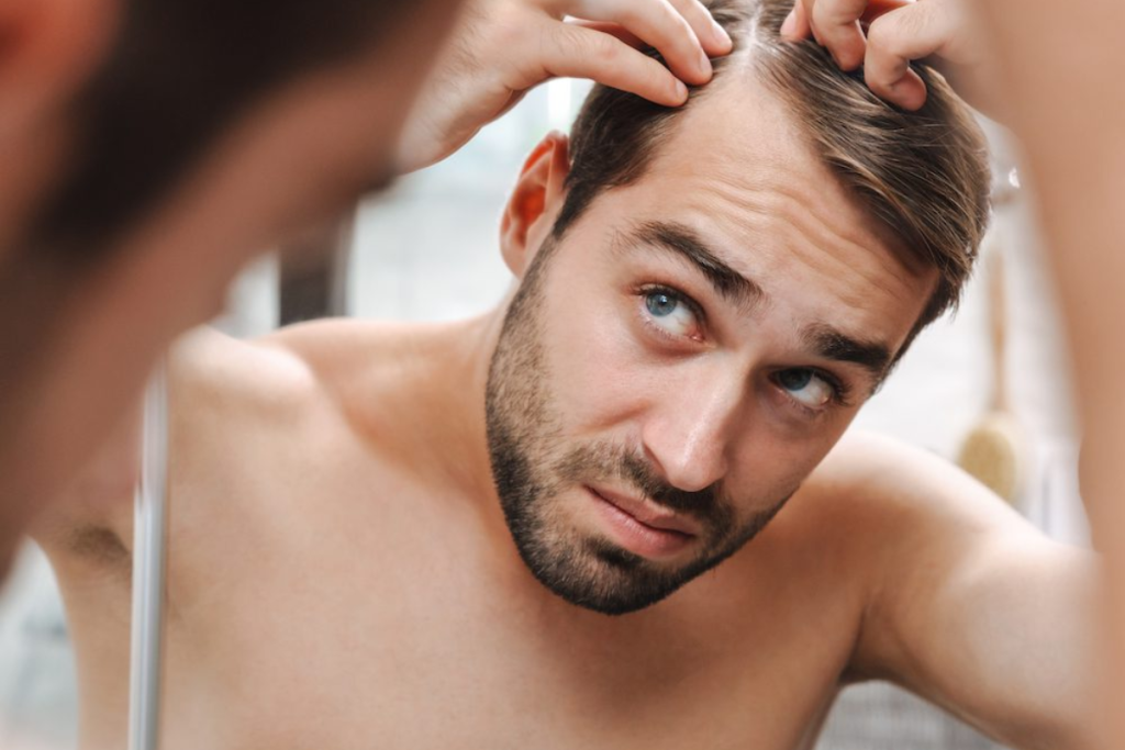 De ce chelesc bărbații