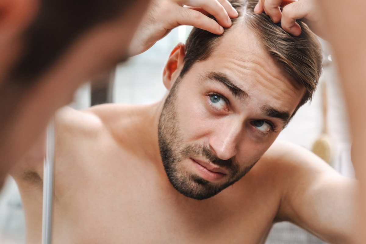 De ce chelesc bărbații